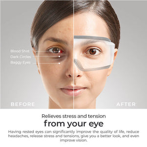 [40% OFF] iCare™ Eye Massager